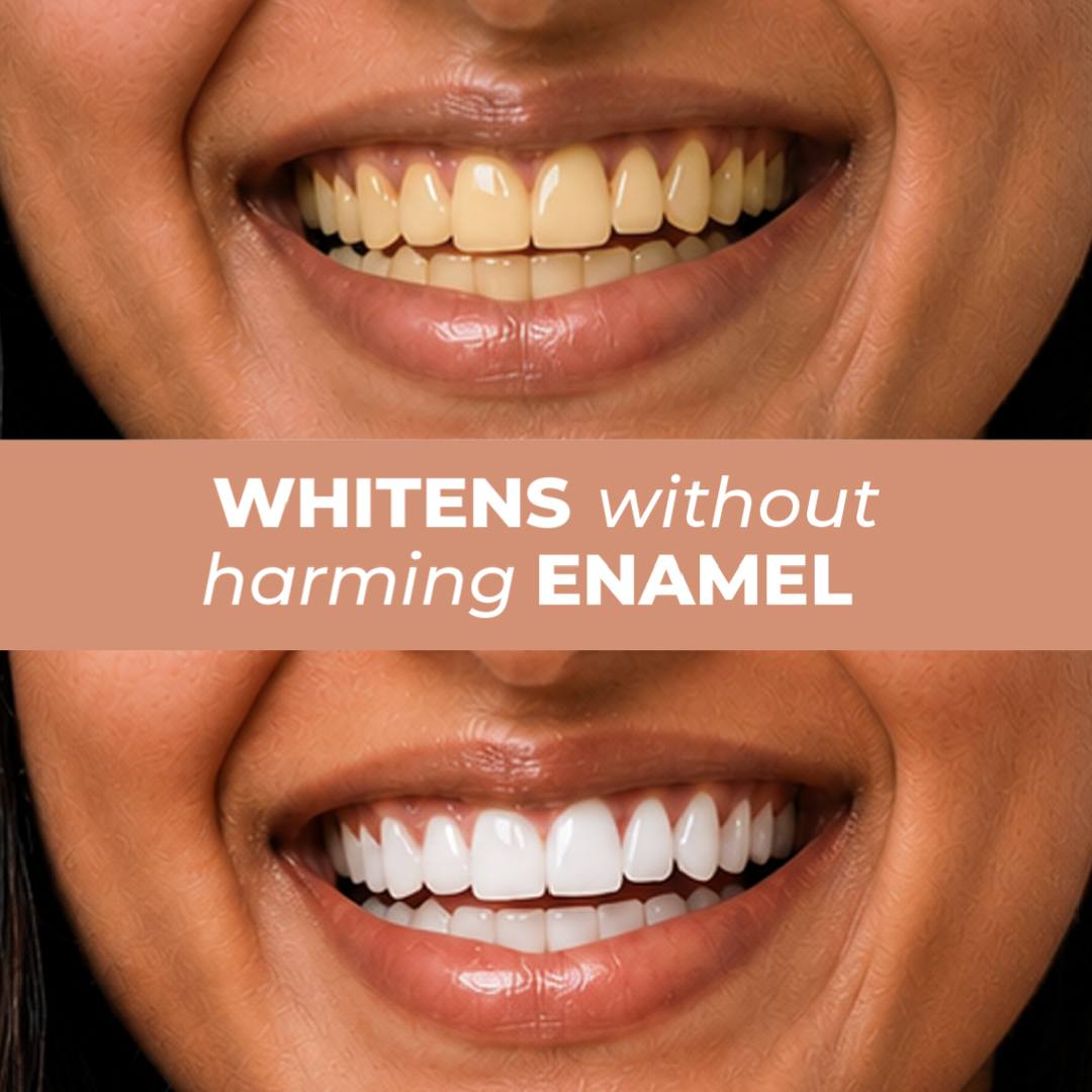Close-up before-and-after comparison of a smiling woman's teeth after using better bright Complete Oral Care Cinnamon mint toothpaste, with the top showing yellowed teeth and the bottom showing bright white teeth. A peach banner across the center reads 'WHITENS without harming ENAMEL'.