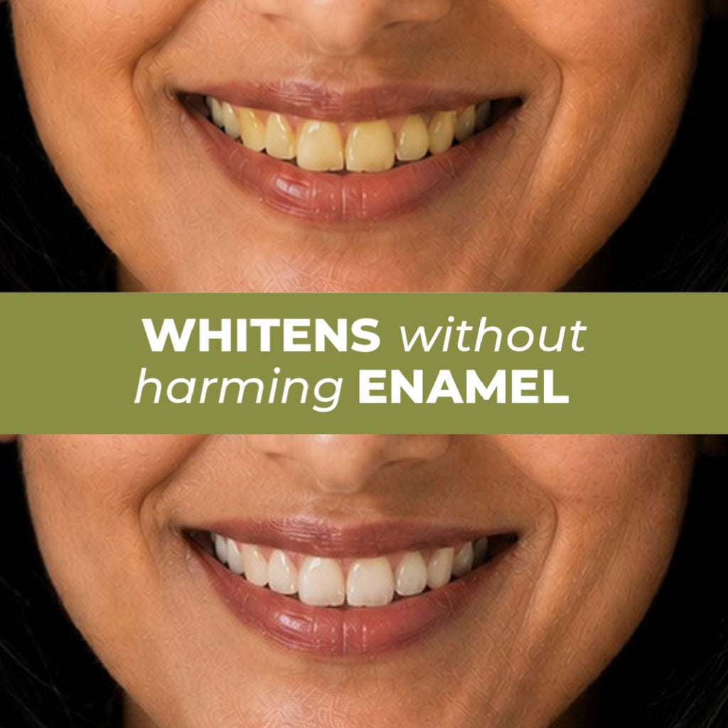 Close-up before-and-after comparison of a smiling woman's teeth after using better bright Complete Oral Care Fennel mint toothpaste, with the top showing yellowed teeth and the bottom showing bright white teeth. A peach banner across the center reads 'WHITENS without harming ENAMEL'.
