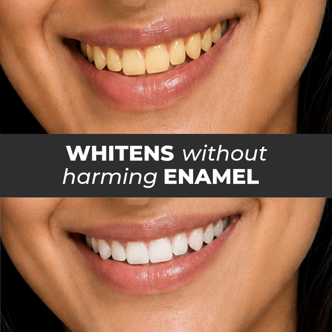 whitens_without_harming_enamel